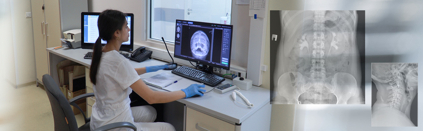 Рентгенодиагностический аппарат на два рабочих места