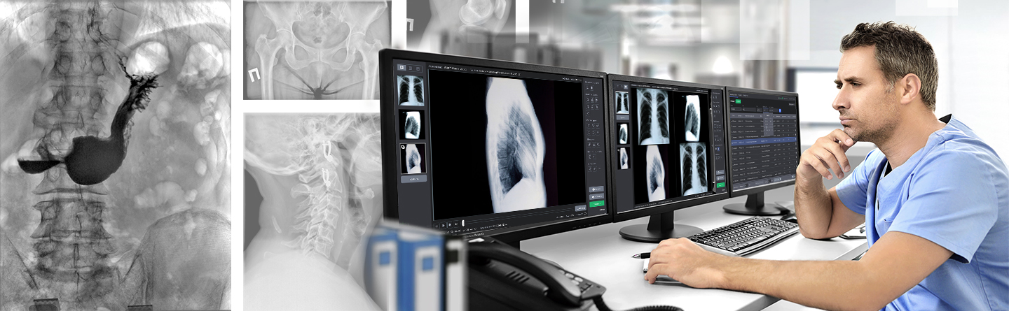 Телеуправляемый рентгенодиагностический аппарат 